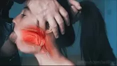 تشغيل Pharynx اللعنة xray